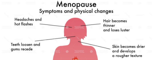 What's happening to me, Is this Menopause? By Karen Cotton
